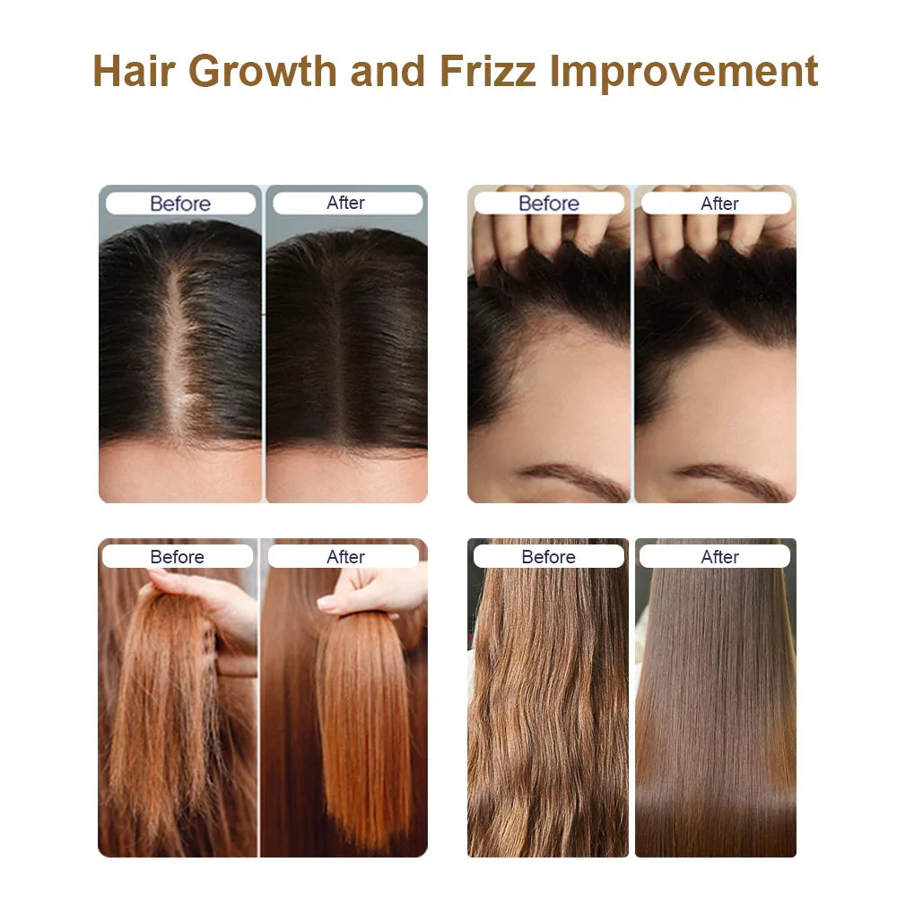 Scalp Oil Liquid Applicator Electric Head Comb Massager 625nm LED Light Therapy Vibration Medicine Hair Growth Massage Combs